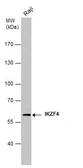 Anti-IKZF4 antibody [GT976] used in Western Blot (WB). GTX629811