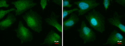 Anti-O-GlcNAc transferase antibody [GT678] used in Immunocytochemistry/ Immunofluorescence (ICC/IF). GTX629812