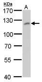 Anti-O-GlcNAc transferase antibody [GT2037] used in Western Blot (WB). GTX629813