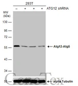 Anti-ATG12 antibody [GT166] used in Western Blot (WB). GTX629815