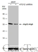 Anti-ATG12 antibody [GT9411] used in Western Blot (WB). GTX629817