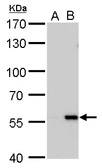 Anti-Carbonic Anhydrase IX antibody [GT546] used in Western Blot (WB). GTX629820