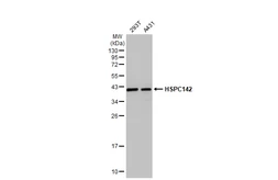 Anti-HSPC142 antibody [GT2810] used in Western Blot (WB). GTX629878
