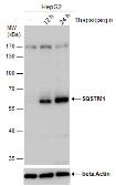 Anti-SQSTM1 / P62 antibody [GT239] used in Western Blot (WB). GTX629888
