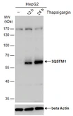 Anti-SQSTM1 / P62 antibody [GT239] used in Western Blot (WB). GTX629888