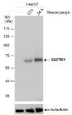 Anti-SQSTM1 / P62 antibody [GT381] used in Western Blot (WB). GTX629889