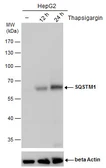 Anti-SQSTM1 / P62 antibody [GT381] used in Western Blot (WB). GTX629889