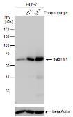 Anti-SQSTM1 / P62 antibody [GT1478] used in Western Blot (WB). GTX629890