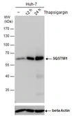 Anti-SQSTM1 / P62 antibody [GT1478] used in Western Blot (WB). GTX629890