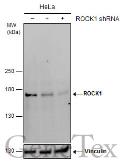 Anti-ROCK1 antibody [GT261] used in Western Blot (WB). GTX629971