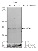 Anti-ROCK1 + ROCK2 antibody [GT261] used in Western Blot (WB). GTX629971