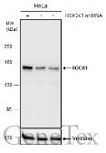 Anti-ROCK1 antibody [GT464] used in Western Blot (WB). GTX629972