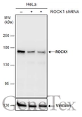 Anti-ROCK1 + ROCK2 antibody [GT464] used in Western Blot (WB). GTX629972