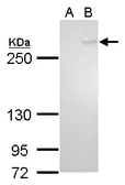 Anti-TET1 antibody [GT465] used in Western Blot (WB). GTX629974