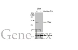 Anti-CDK4 antibody [GT624] used in Western Blot (WB). GTX629975