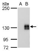 Anti-mCherry antibody [GT235] used in Western Blot (WB). GTX630144
