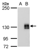 Anti-mCherry antibody [GT235] used in Western Blot (WB). GTX630144