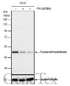 Anti-Fumarate hydratase antibody [GT548] used in Western Blot (WB). GTX630145