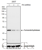 Anti-Fumarate hydratase antibody [GT548] used in Western Blot (WB). GTX630145