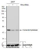 Anti-Fumarate hydratase antibody [GT7612] used in Western Blot (WB). GTX630146