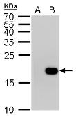 Anti-Histone H3S10ph (phospho Ser10) antibody [GT921] used in Western Blot (WB). GTX630185