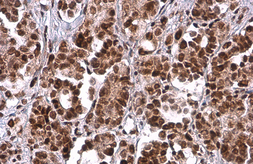 Anti-PRMT1 antibody [GT779] used in IHC (Paraffin sections) (IHC-P). GTX630186