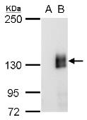 Anti-mCherry antibody [GT857] used in Western Blot (WB). GTX630189