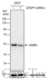 Anti-CFDP1 antibody [GT11811] used in Western Blot (WB). GTX630190