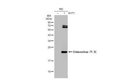 Anti-Enterovirus 71 3C antibody [B3] used in Western Blot (WB). GTX630191