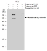 Anti-Enterovirus 71 3D antibody [4] used in Western Blot (WB). GTX630193