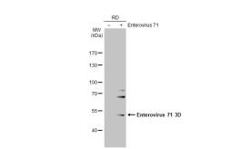 Anti-Enterovirus 71 3D antibody [4] used in Western Blot (WB). GTX630193