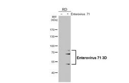 Anti-Enterovirus 71 3D antibody [4] used in Western Blot (WB). GTX630193