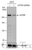 Anti-mTOR antibody [GT649] used in Western Blot (WB). GTX630198