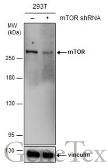 Anti-mTOR antibody [GT778] used in Western Blot (WB). GTX630200