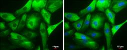 Anti-Nestin antibody [GT623] used in Immunocytochemistry/ Immunofluorescence (ICC/IF). GTX630201