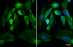 Anti-Nestin antibody [GT623] used in Immunocytochemistry/ Immunofluorescence (ICC/IF). GTX630201