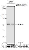 Anti-CSE1L antibody [GT5111] used in Western Blot (WB). GTX630394