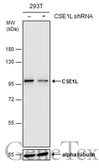 Anti-CSE1L antibody [GT5111] used in Western Blot (WB). GTX630394
