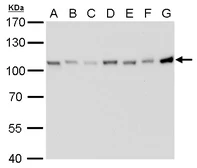 Anti-CSE1L antibody [GT729] used in Western Blot (WB). GTX630395