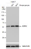 Anti-NDP52 antibody [GT422] used in Western Blot (WB). GTX630396