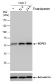 Anti-NDP52 antibody [GT422] used in Western Blot (WB). GTX630396