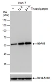 Anti-NDP52 antibody [GT1813] used in Western Blot (WB). GTX630397