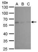 Anti-NDP52 antibody [GT17410] used in Western Blot (WB). GTX630398