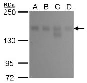 Anti-KDM6A antibody [GT1612] used in Western Blot (WB). GTX630412