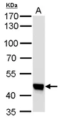 Anti-UQCRC1 antibody [GT139] used in Western Blot (WB). GTX630413
