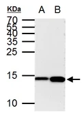 Anti-Histone H3K9ac (Acetyl Lys9) antibody [GT464] used in Western Blot (WB). GTX630554