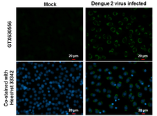 Anti-Dengue virus NS1 protein antibody [GT4212] used in Immunocytochemistry/ Immunofluorescence (ICC/IF). GTX630556