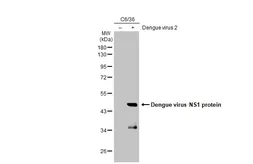 Anti-Dengue virus NS1 protein antibody [GT1061] used in Western Blot (WB). GTX630557