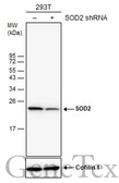 Anti-SOD2 antibody [GT582] used in Western Blot (WB). GTX630558
