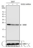 Anti-SOD2 antibody [GT1433] used in Western Blot (WB). GTX630559